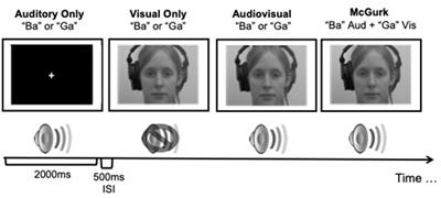 Perception of the McGurk effect in people with one eye depends on whether the eye is removed during infancy or adulthood